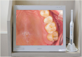 目で見る歯周病治療